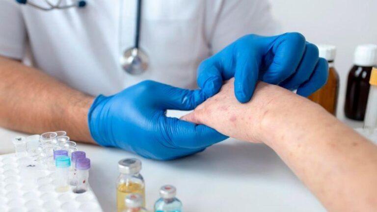 Brote de sarampión en México: Estos son los estados con más casos confirmados hasta HOY 21 de enero | MAPA