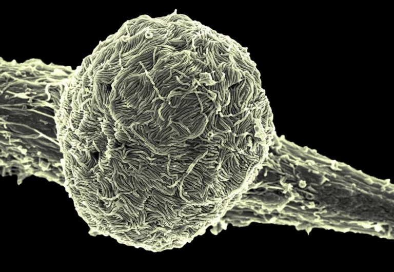 Ssa elabora protocolos especiales para detectar posibles casos de ébola en el marco del Mundial 2026