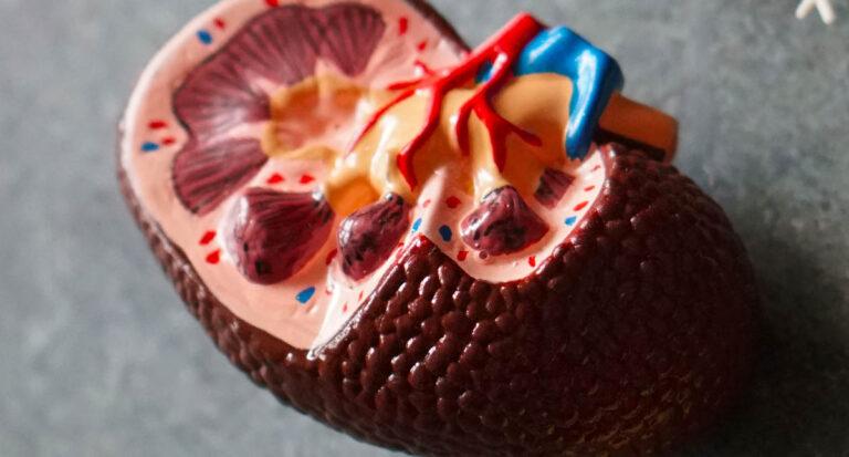 OMS alerta falsificación de medicamento usado en trasplantados de riñón