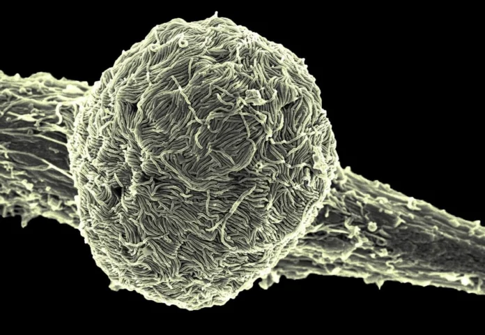 ssa-elabora-protocolos-especiales-para-detectar-casos-de-ebola-de-cara-al-mundial-2026