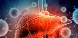 Hepatitis C: 95% curable, pero 400 mil mexicanos lo ignoran