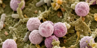 Salud descarta brote de ciclosporiasis en México; mantiene vigilancia epidemiológica